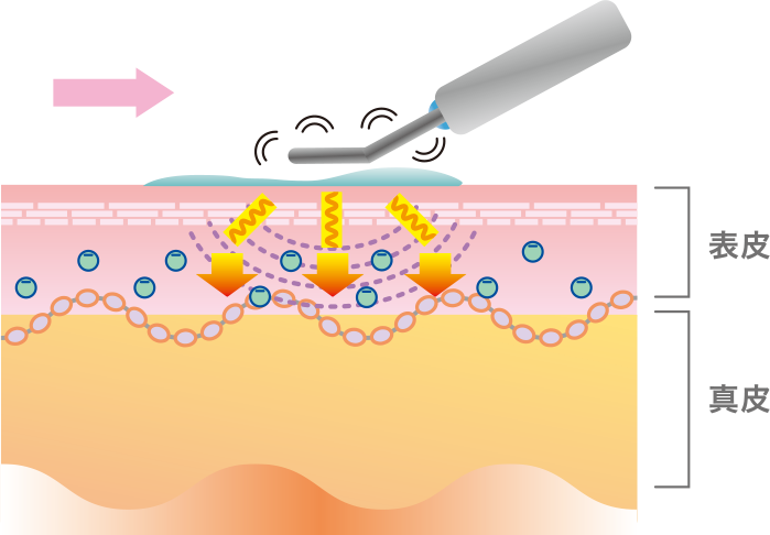 C-ION（+ -）/PATTING